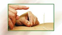 La acupuntura, una medicina eficaz